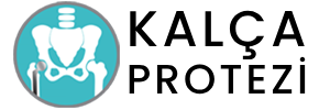 Kalca Protez