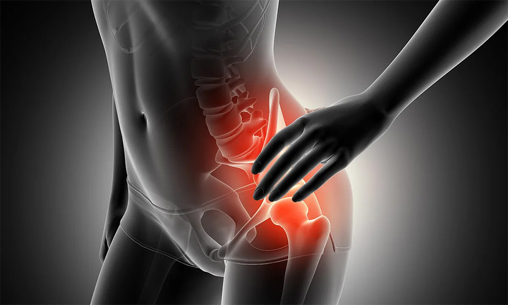 Kalça Protezi Ameliyatı