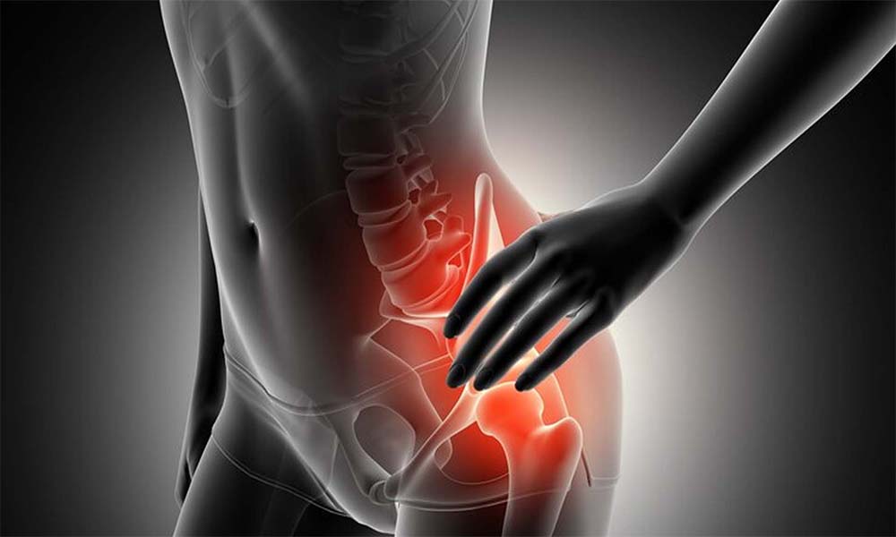 Parsiyel Kalça Protezi Nedir?