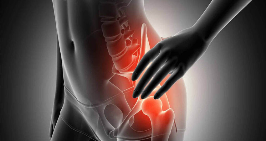 Kalça Çıkığı Ameliyatı