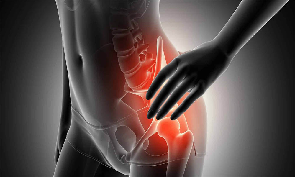 Kalça Çıkığı Ameliyatı