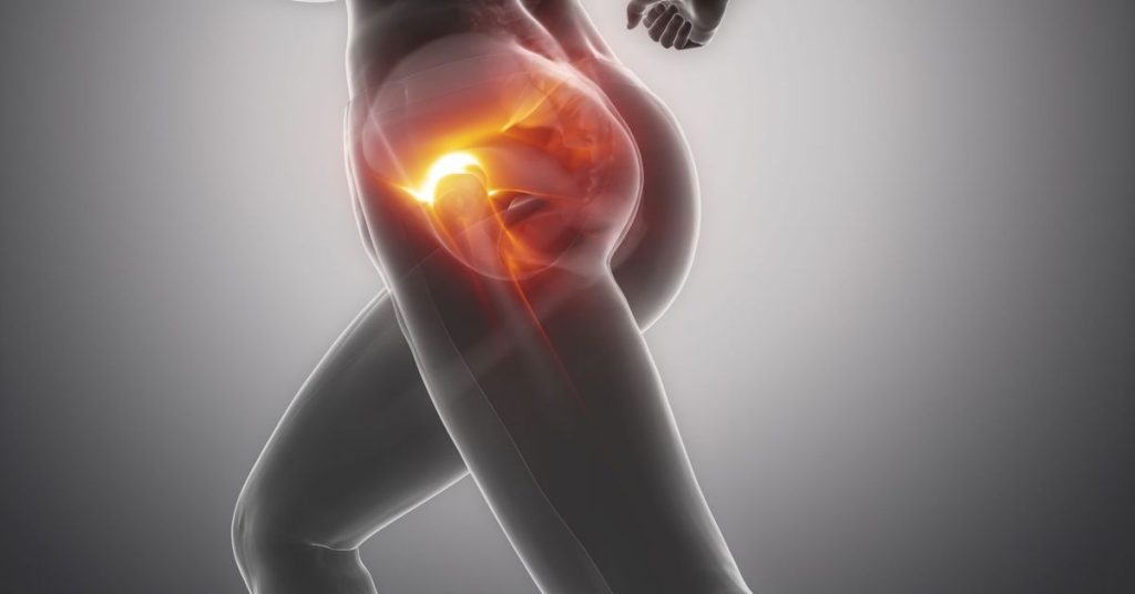 Total Kalça Protez Ameliyatı